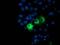 Protein Phosphatase, Mg2+/Mn2+ Dependent 1B antibody, MA5-25538, Invitrogen Antibodies, Immunocytochemistry image 