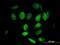 WAPL Cohesin Release Factor antibody, H00023063-B01P, Novus Biologicals, Immunocytochemistry image 