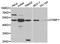 Dystrobrevin Binding Protein 1 antibody, TA327114, Origene, Western Blot image 