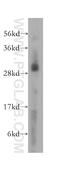 Mitochondrial Ribosomal Protein L10 antibody, 16652-1-AP, Proteintech Group, Western Blot image 