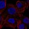 Protein Phosphatase, Mg2+/Mn2+ Dependent 1M antibody, NBP2-56555, Novus Biologicals, Immunofluorescence image 