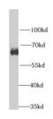 Heterogeneous Nuclear Ribonucleoprotein L antibody, FNab03956, FineTest, Western Blot image 