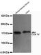 Cytochrome C Oxidase Subunit 4I1 antibody, GTX49132, GeneTex, Western Blot image 