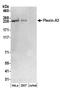 Plexin A3 antibody, A304-473A, Bethyl Labs, Western Blot image 