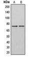 DM1 Protein Kinase antibody, LS-C352120, Lifespan Biosciences, Western Blot image 