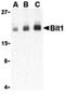 Peptidyl-TRNA Hydrolase 2 antibody, LS-C19533, Lifespan Biosciences, Western Blot image 