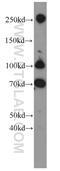Fibronectin 1 antibody, 15613-1-AP, Proteintech Group, Western Blot image 