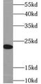 Interleukin 23 Subunit Alpha antibody, FNab04256, FineTest, Western Blot image 