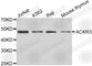 Atypical Chemokine Receptor 3 antibody, A3468, ABclonal Technology, Western Blot image 