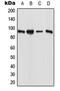 Establishment Of Sister Chromatid Cohesion N-Acetyltransferase 1 antibody, GTX55980, GeneTex, Western Blot image 