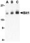 Peptidyl-TRNA Hydrolase 2 antibody, A02459-1, Boster Biological Technology, Western Blot image 