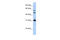 Homeobox protein Hox-B5 antibody, 27-127, ProSci, Enzyme Linked Immunosorbent Assay image 