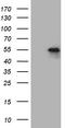 Pleckstrin homology-like domain family A member 1 antibody, TA810937S, Origene, Western Blot image 