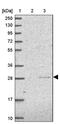 EEF1A Lysine Methyltransferase 2 antibody, PA5-62143, Invitrogen Antibodies, Western Blot image 