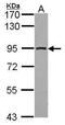 Aconitase antibody, GTX114233, GeneTex, Western Blot image 