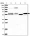 PPRC1 antibody, PA5-58420, Invitrogen Antibodies, Western Blot image 