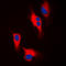 Tyrosine Hydroxylase antibody, LS-C354112, Lifespan Biosciences, Immunofluorescence image 