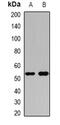 Angiotensinogen antibody, abx225020, Abbexa, Western Blot image 