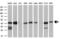 Carnosine N-Methyltransferase 1 antibody, GTX84740, GeneTex, Western Blot image 