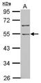 BTB/POZ domain-containing protein 10 antibody, GTX108739, GeneTex, Western Blot image 