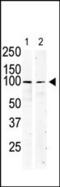 c-Kit antibody, MBS9204642, MyBioSource, Western Blot image 