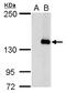 Jumonji And AT-Rich Interaction Domain Containing 2 antibody, GTX129021, GeneTex, Western Blot image 