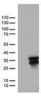 O-6-Methylguanine-DNA Methyltransferase antibody, UM800007, Origene, Western Blot image 