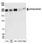 Eukaryotic translation initiation factor 4 gamma 3 antibody, A301-768A, Bethyl Labs, Western Blot image 