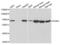 Phosphoglucomutase 1 antibody, abx004818, Abbexa, Western Blot image 