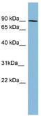 Protein kinase C beta type antibody, TA342146, Origene, Western Blot image 