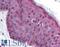 MDM2 Proto-Oncogene antibody, LS-B163, Lifespan Biosciences, Immunohistochemistry paraffin image 