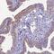 Cilia And Flagella Associated Protein 47 antibody, HPA044633, Atlas Antibodies, Immunohistochemistry paraffin image 
