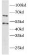Eyes absent homolog 1 antibody, FNab02913, FineTest, Western Blot image 