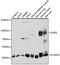 Dystroglycan 1 antibody, A01369, Boster Biological Technology, Western Blot image 