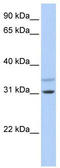 Potassium Channel Regulator antibody, TA338774, Origene, Western Blot image 