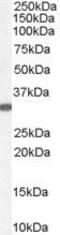 Voltage Dependent Anion Channel 2 antibody, PA5-18264, Invitrogen Antibodies, Western Blot image 