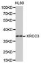 X-Ray Repair Cross Complementing 3 antibody, orb136503, Biorbyt, Western Blot image 