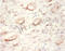 YARS antibody, A52632-100, Epigentek, Immunohistochemistry paraffin image 