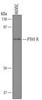 Parathyroid Hormone 1 Receptor antibody, AF5709, R&D Systems, Western Blot image 