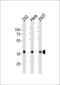 Ubiquitin C-Terminal Hydrolase L5 antibody, MA5-18114, Invitrogen Antibodies, Western Blot image 