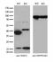 Non-Homologous End Joining Factor 1 antibody, M03552, Boster Biological Technology, Western Blot image 