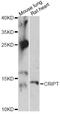 CXXC Repeat Containing Interactor Of PDZ3 Domain antibody, LS-C749338, Lifespan Biosciences, Western Blot image 