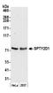 SPT2 Chromatin Protein Domain Containing 1 antibody, A304-996A, Bethyl Labs, Western Blot image 