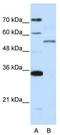 Zinc Finger Protein 707 antibody, TA345597, Origene, Western Blot image 
