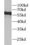 YTH N6-Methyladenosine RNA Binding Protein 3 antibody, FNab09574, FineTest, Western Blot image 