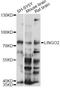 Leucine Rich Repeat And Ig Domain Containing 2 antibody, LS-C749948, Lifespan Biosciences, Western Blot image 