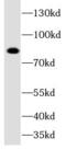 Serine/threonine-protein kinase DCLK1 antibody, FNab02266, FineTest, Western Blot image 