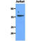 SDH antibody, GTX57595, GeneTex, Western Blot image 