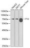 Coagulation Factor XII antibody, GTX53993, GeneTex, Western Blot image 