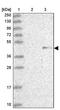 Zinc Finger Protein 239 antibody, PA5-61279, Invitrogen Antibodies, Western Blot image 